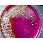 Picture of They design a bioplástico antimicrobic from gluten of wheat