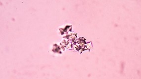 Foto de La Sociedad Española de Medicina de Laboratorio, primer acreditado por ENAC para programas de intercomparación con imágenes de microscopía de sedimento urinario