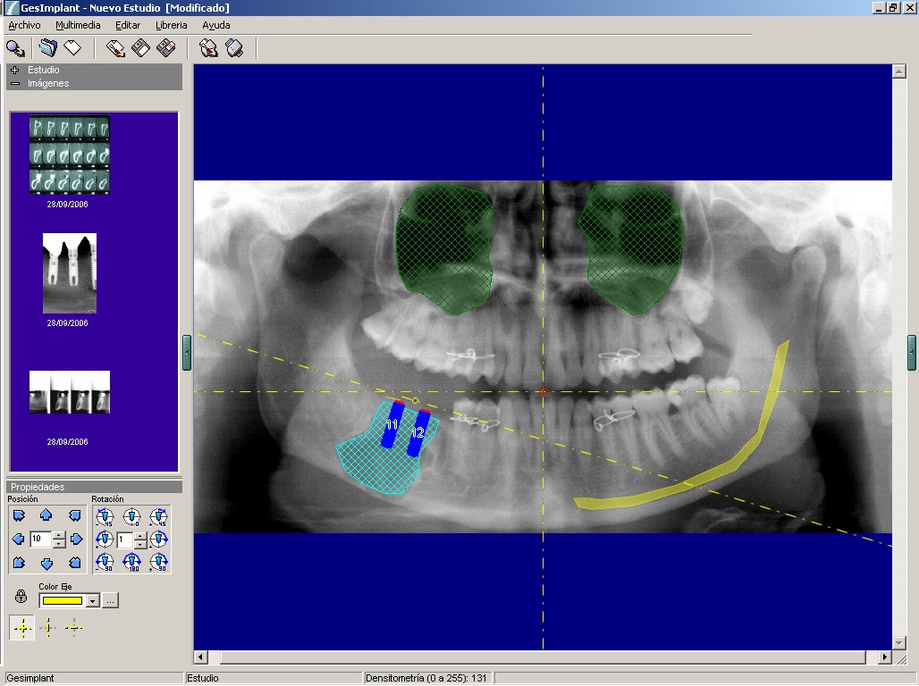 Foto de Software de comunicación tratamientos implantológicos