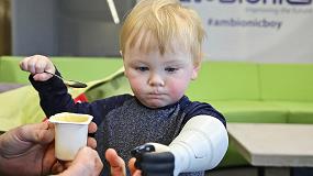Foto de Un padre autodidacta desarrolla una prtesis hidrulica personalizada impresa en 3D para su hijo