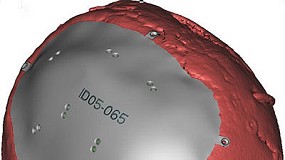 Foto de El proyecto europeo Custom IMD, basado en los implantes mdicos, celebra su primera reunin anual