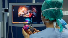 Foto de El Hospital de Burdeos mejora la ciruga de cncer de rin gracias a la impresin 3D a color