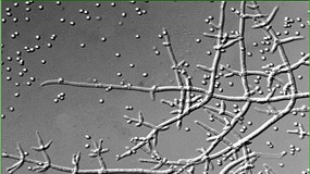 Foto de Nueva regulación para el hongo Trichoderma que actúa a la vez como fitosanitario y como biofertilizante