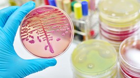 Fotografia de [es] Un estudio aborda la funcin de las bacterias intestinales para desarrollar nuevos probiticos