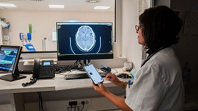 Foto de La IA permite al Hospital General de Granollers acelerar el diagnstico de pacientes con ictus