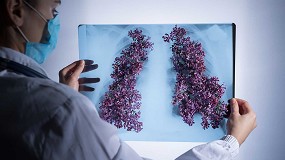 Foto de Una empresa cofundada por un investigador del CSIC recibe 9 millones de euros para desarrollar terapias que combatan la fibrosis pulmonar