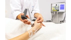 Foto de Radiofrecuencia para cicatrices: cmo tratar con eficacia el tejido daado