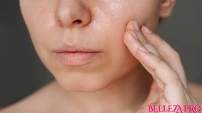 Foto de ¿Las pieles grasas envejecen mejor? Mito o realidad desde la perspectiva dermocosmética
