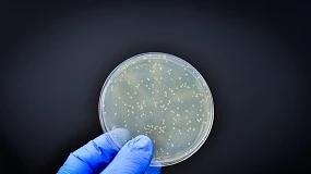 Foto de Más del 70% de los genes de resistencia a los antibióticos están en la cadena alimentaria
