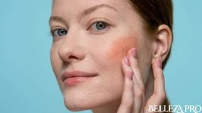 Foto de Cómo eliminar las cicatrices del acné: los tratamientos más eficaces según la Dra. Beatriz Beltrán