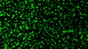 Foto de Descubren que un coronavirus porcino utiliza una va inesperada para entrar en las clulas