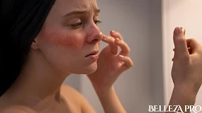 Foto de El frío dispara las rojeces: cómo combatirlas con la innovación coreana de Blemish Control