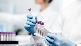 Foto de CirPol desenvolve processo inovador para transformar res�duos hospitalares polim�ricos em materiais reutiliz�veis