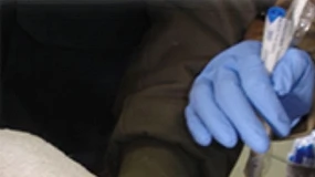 Foto de Avances en el conocimiento de la microbiota respiratoria en ovino y caprino