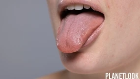 Foto de La posición de la lengua puede influir en la estructura facial, según Yvette Pons