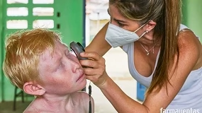Foto de ISDIN ha atendido en cuatro años a más de 5.400 personas con albinismo en Panamá y Mozambique