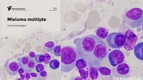 Foto de El papel del farmacéutico en el uso seguro y adecuado del tratamiento del mieloma múltiple