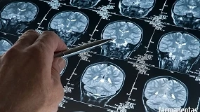 Foto de La Medicina de Precisión avanza hacia el diagnóstico biológico del Alzheimer