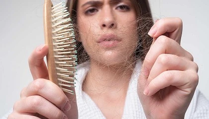 Foto de Cmo combatir la cada de cabello reaccional?