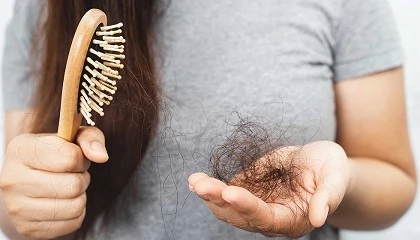 Foto de Por qu se acenta la cada del cabello en primavera?