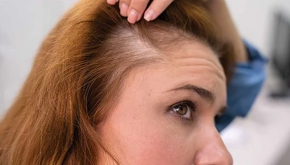 Foto de Ronquina de Armonía Cosmética Natural: tratamiento anticaída y revitalizante