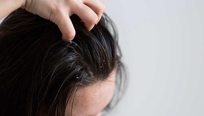 Foto de El cuero cabelludo es la nueva piel: la gua de Miriam Quevedo para preparar el cabello antes del verano