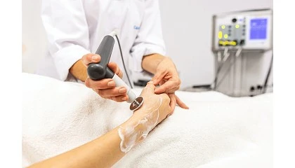 Foto de Radiofrecuencia para cicatrices: cmo tratar con eficacia el tejido daado