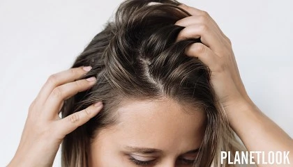 Foto de Te suda demasiado la cabeza? Esto puede estar detrs y as debes actuar como profesional