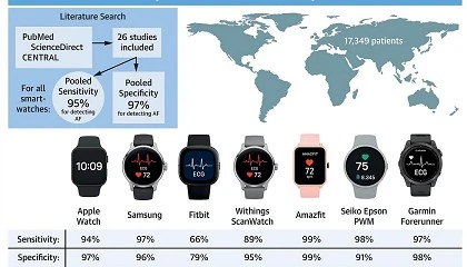 Foto de Amazfit, el smartwatch más preciso en la detección de fibrilación auricular