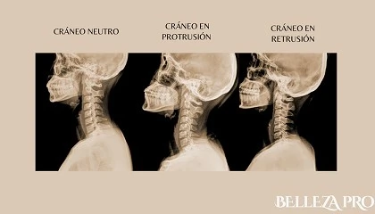 Foto de Yvette Pons presenta AHA, un m�todo que relaciona la postura corporal con el envejecimiento facial