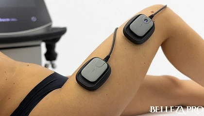 Foto de Termosalud presenta Zionic Pro Max e In�o en Professional Beauty Barcelona 2026