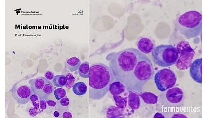 Foto de El papel del farmac�utico en el uso seguro y adecuado del tratamiento del mieloma m�ltiple