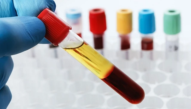 Foto de La EMA certifica por primera vez plasma de África y Oriente Medio para fabricar hemoderivados en la UE