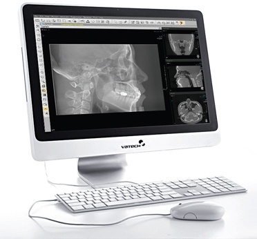Foto de Software de imágenes dentales