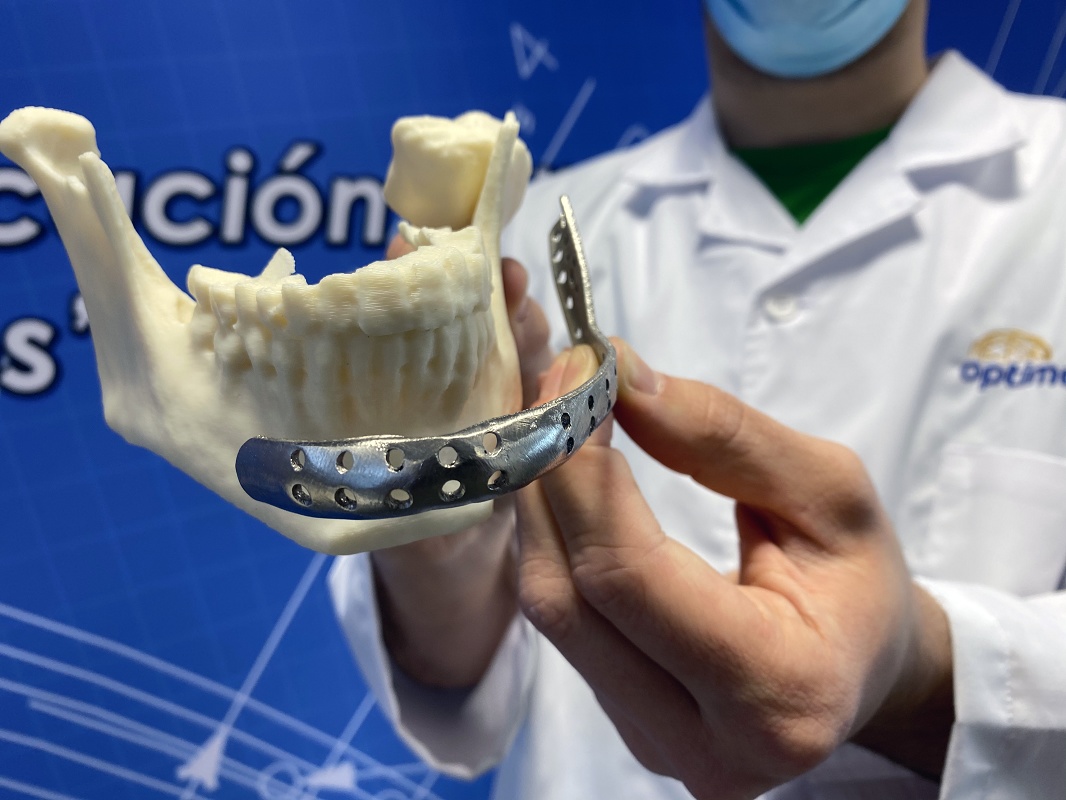 Foto de Servicios de Impresión 3D metálica de implantes ortopédicos
