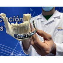 Servicios de Impresin 3D metlica de implantes ortopdicos