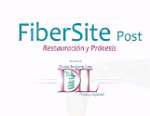Sistema de implantes FiberSite Post