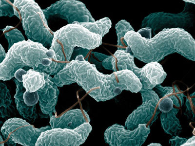500 clulas de Campylobacter jejuni son suficientes para causar la enfermedad