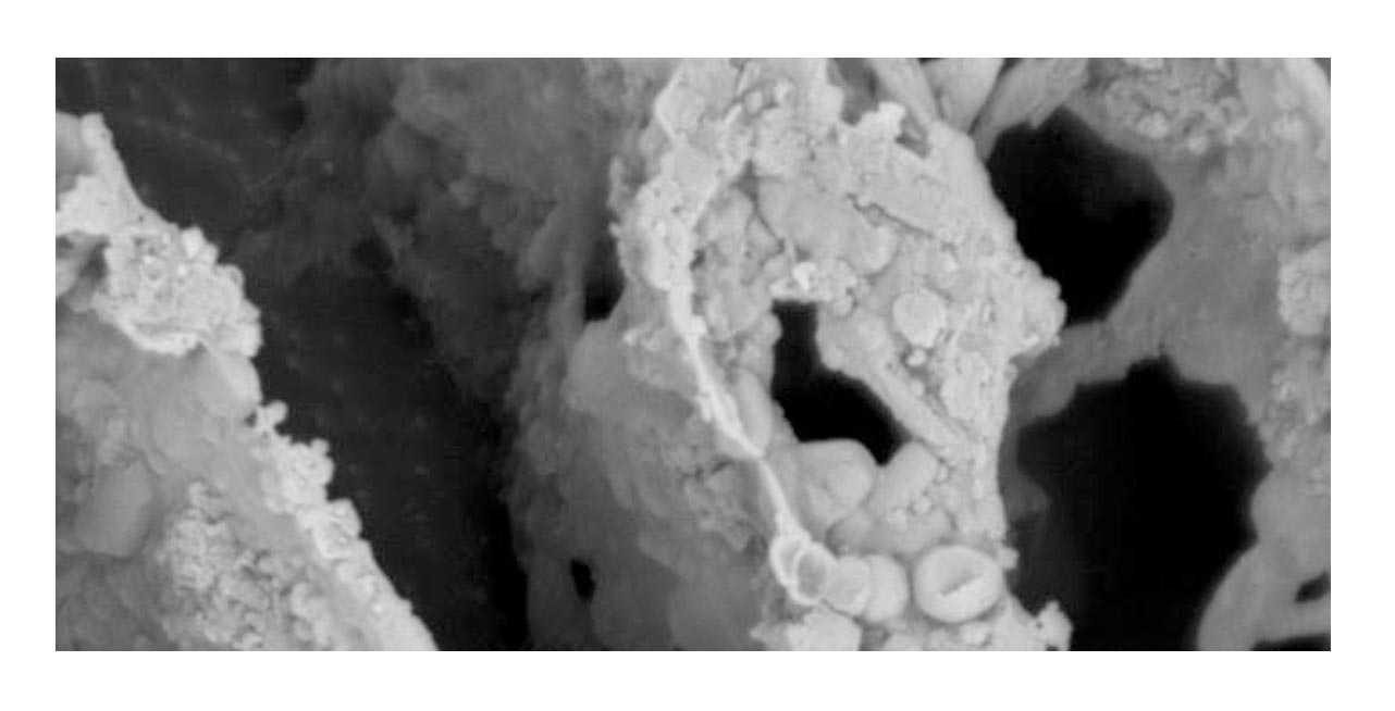 Muestra de microbiota de heces de un individuo sano obtenida mediante microscopio