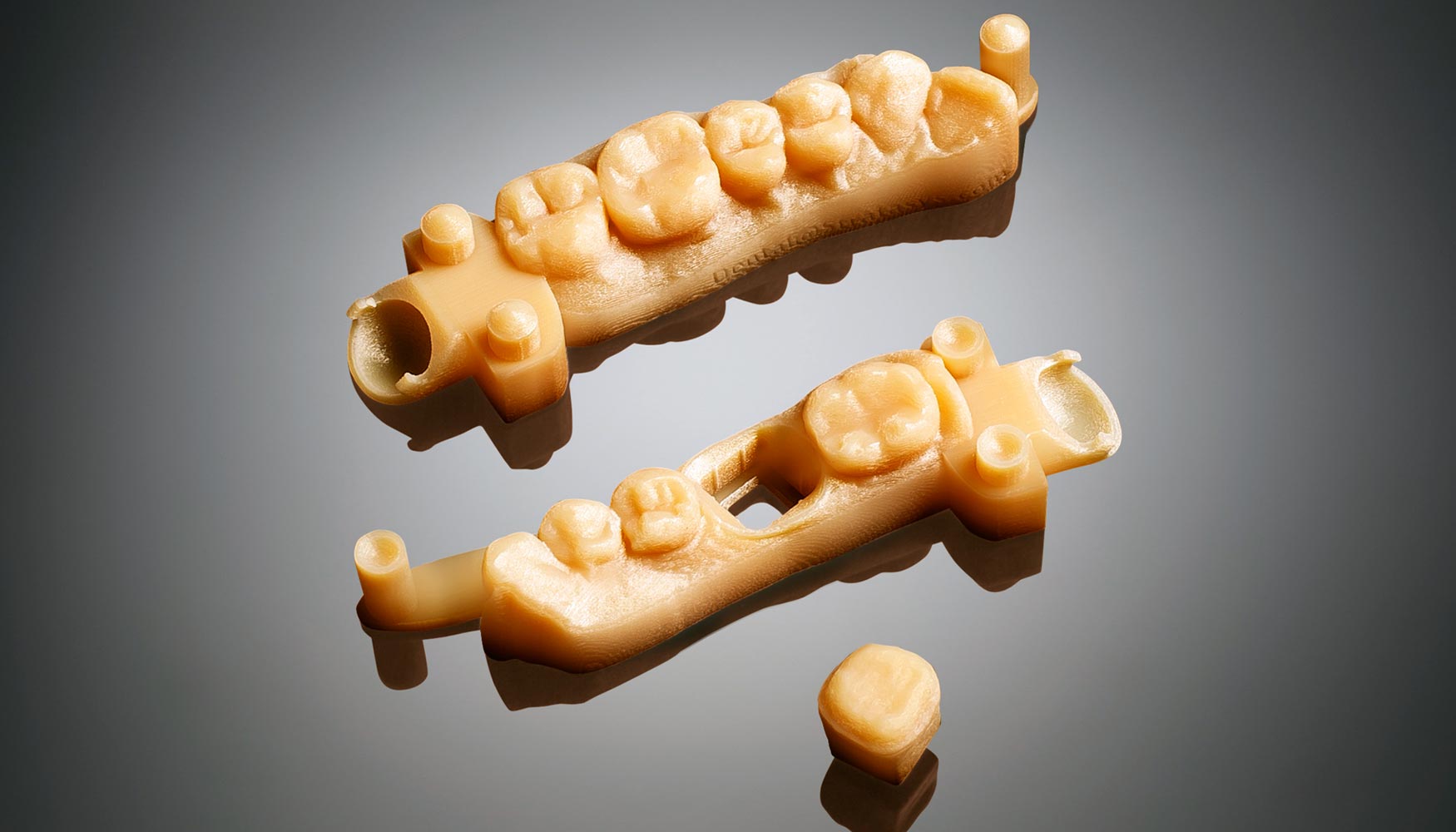 Modelos cermicos de corona y puente fabricados con material MED690 en la impresora 3D Objet30 Dental Prime...