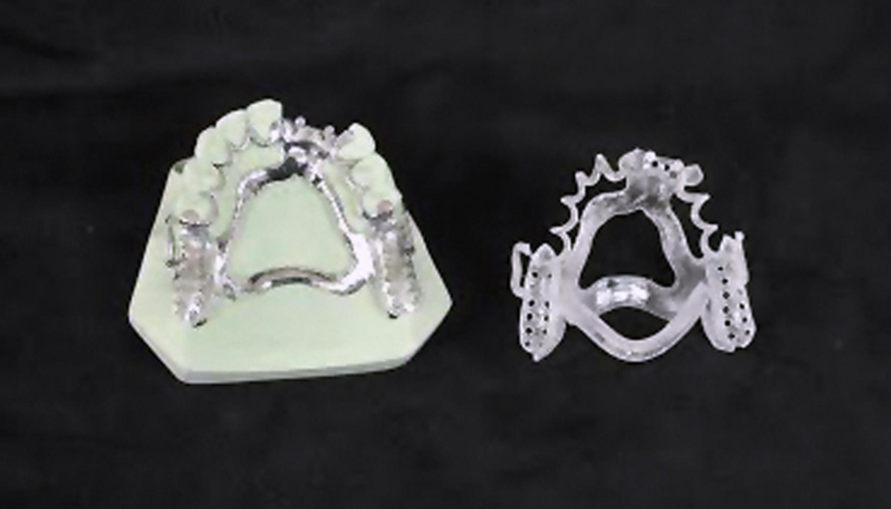 Permite imprimir patrones de vaciado para prtesis removibles fabricadas con material MED610 en la compacta y verstil impresora 3D Objet30 Dental...