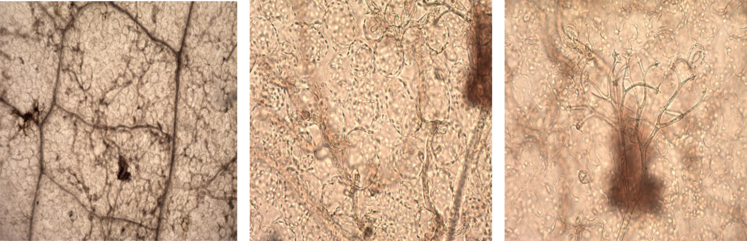 Figura 1. Hifas de Bremia lactucae en hoja de lechuga (izquierda), hifas y haustorios (centro) y esporangiforos de fructificacin (derecha)...