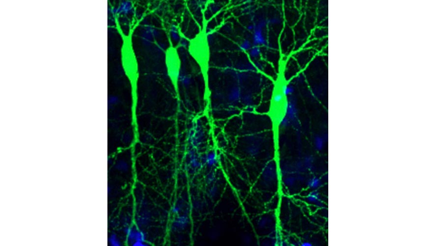 Neuronas expresando beta-amiloide