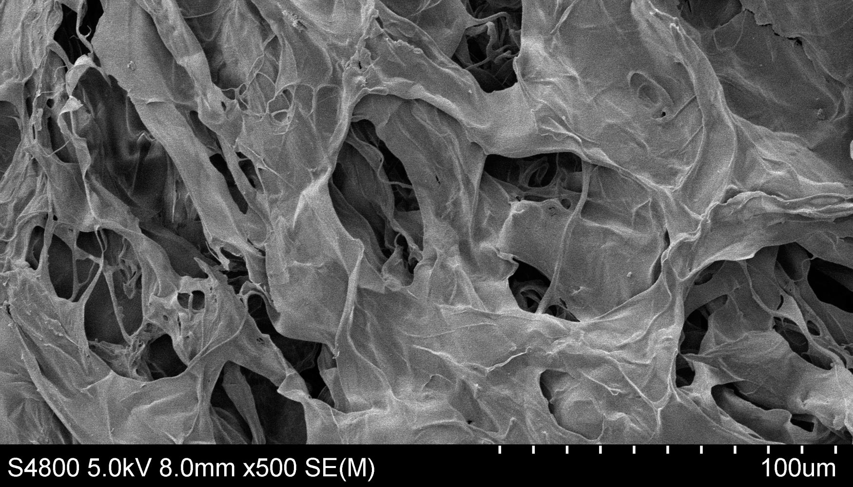 Nanoandamios de chitosan y nanotubos de carbono que mimetizan hueso humano