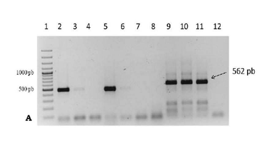 Foto 4. Deteccin de los virus PLRV (A) y PVX (B) mediante PCR. (Gil et al., 2011)