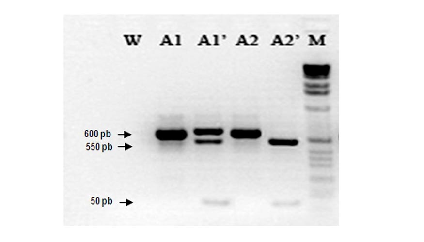 Foto 7. Identificacin de aislados A1 y A2 de mildiu, mediante PCR especfica