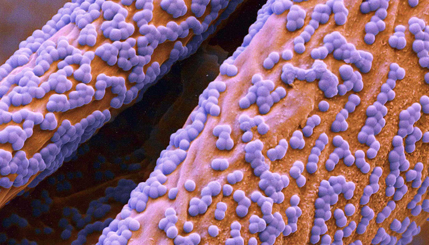 Nanopartculas de tipo esfrico recubren unas fibras de algodn, y evitan la humedad y que se ensucien