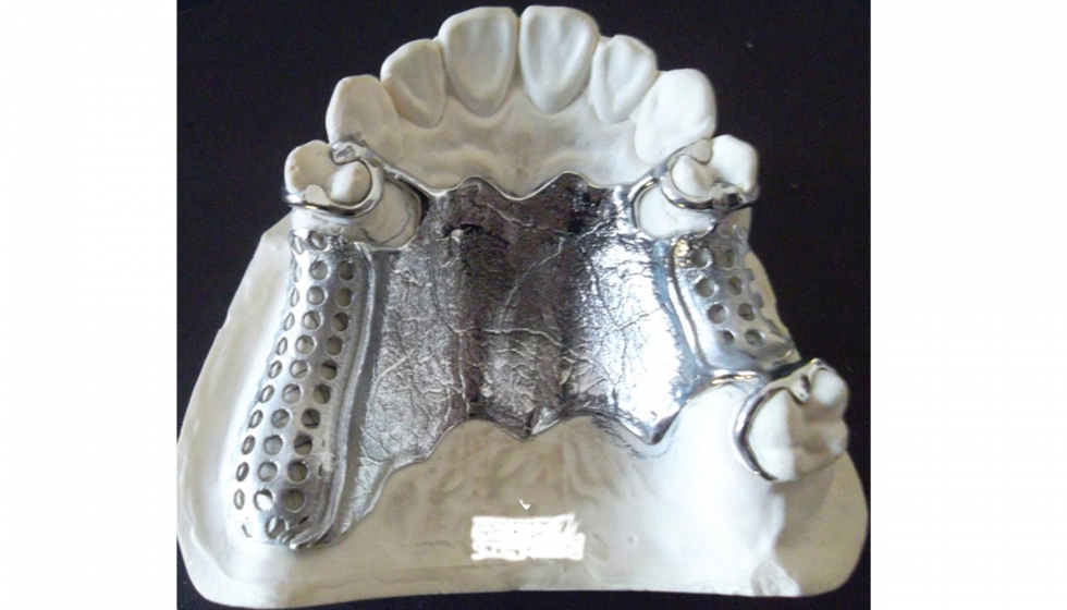 Aplicaciones de metal en implantes dentales fabricados en 3D. Foto: 3D Systems