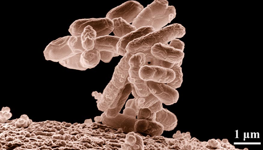 Bacterias E. coli