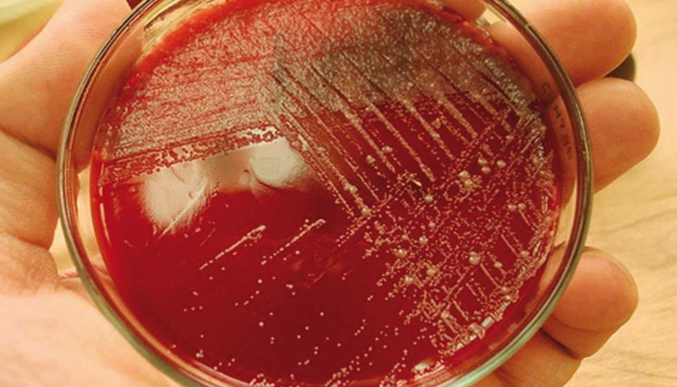 Figura 1. Apariencia de las colonias de Campylobacter creciendo en medio slido Mueller-Hinton sangre (MHS)